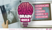 Brain Quiz